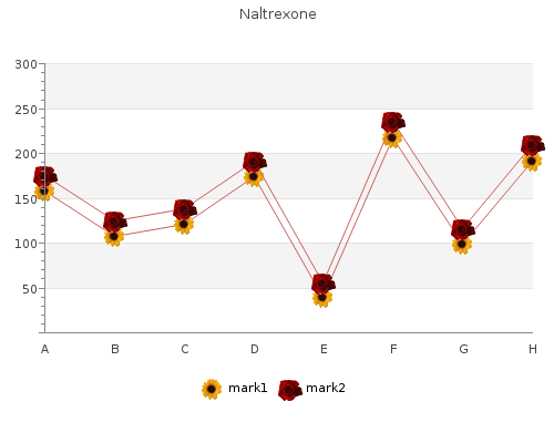 generic naltrexone 50mg with mastercard