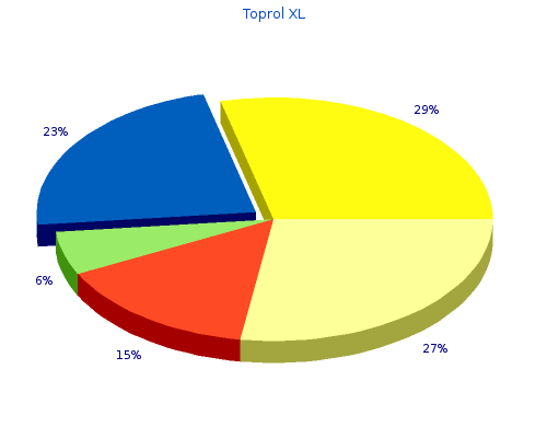 toprol xl 100 mg for sale