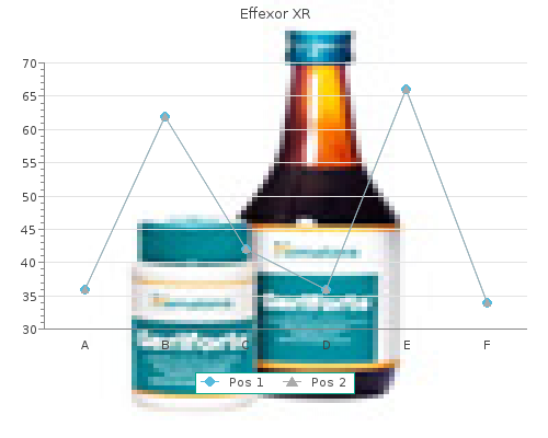 proven effexor xr 150 mg