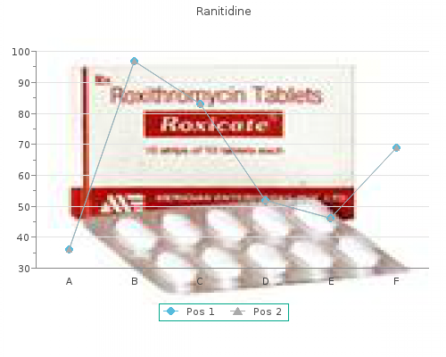 order ranitidine 150 mg overnight delivery