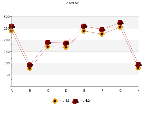 order 300 mg zantac with amex