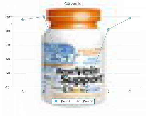 purchase carvedilol 25 mg on-line